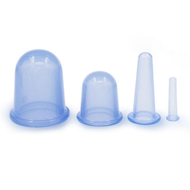 Silicone cupping therapy set — 4 blue cups in graduated sizes
